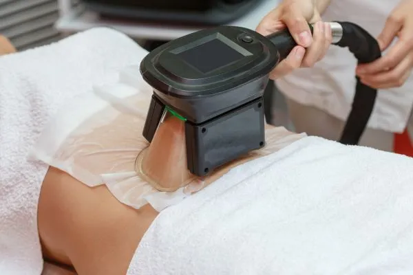 Image of person having fat freezing treatment to help weight gain New Scarborough