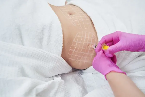 image of fat dissolving injections on love handles to help combat weight gain New Scarborough