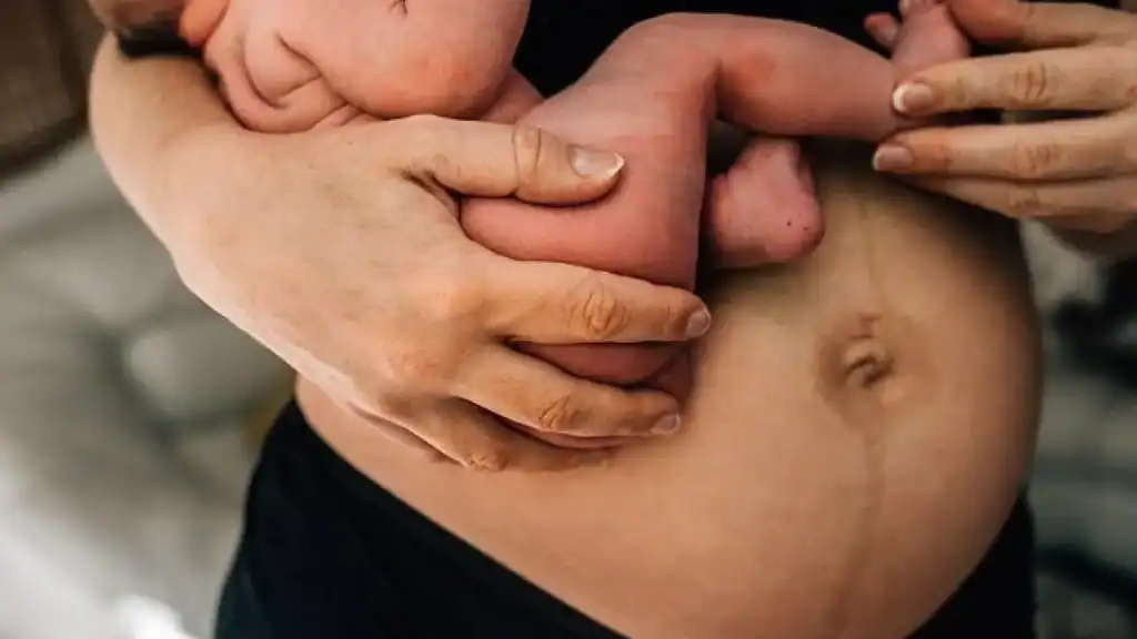 Why Is My Stomach Still Big After Pregnancy New Scarborough?